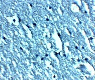 Immunohistochemistry: TRPC3 Antibody - BSA Free [NBP2-82043]