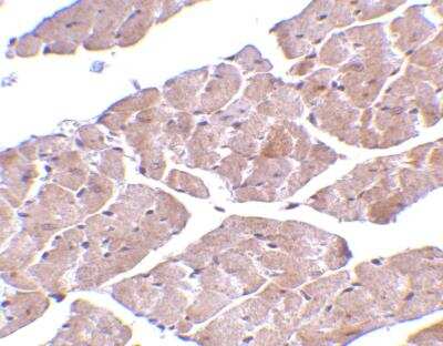 Immunohistochemistry-Paraffin: TRPC3 Antibody - BSA Free [NBP1-77262]