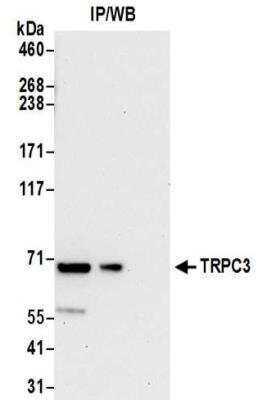 Immunoprecipitation: TRPC3 Antibody [NBP2-32258]