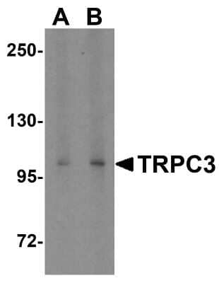 Western Blot: TRPC3 AntibodyBSA Free [NBP1-76722]