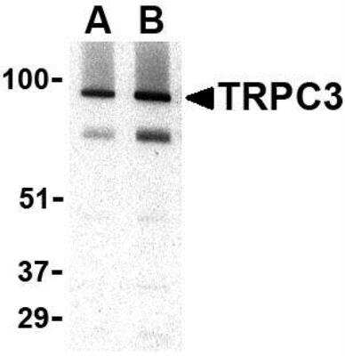 Western Blot: TRPC3 AntibodyBSA Free [NBP1-77262]