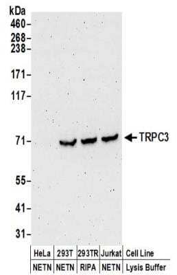 Western Blot: TRPC3 Antibody [NBP2-32258]