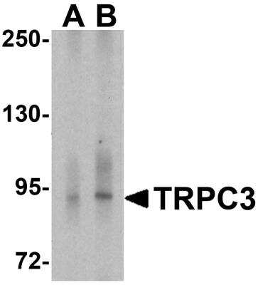 Western Blot: TRPC3 AntibodyBSA Free [NBP2-82043]