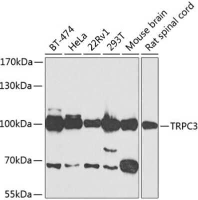 Western Blot: TRPC3 AntibodyBSA Free [NBP2-93499]