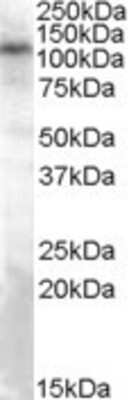 Western Blot: TRPC4 Antibody [NBP1-20989]