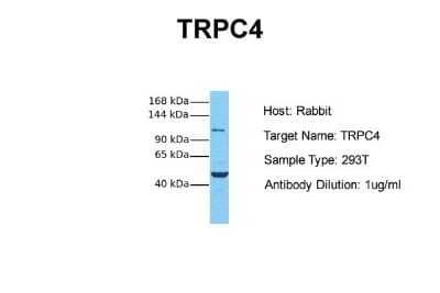 Western Blot: TRPC4 Antibody [NBP2-82362]