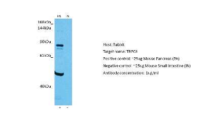 Western Blot: TRPC4 Antibody [NBP2-82362]