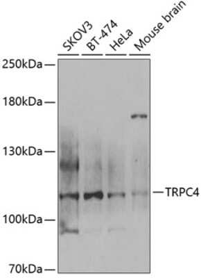 Western Blot: TRPC4 AntibodyBSA Free [NBP2-95240]