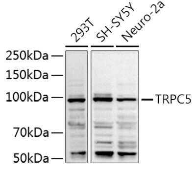 Western Blot: TRPC5 AntibodyAzide and BSA Free [NBP2-94585]