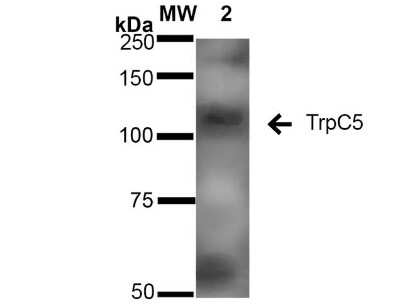 Western Blot: TRPC5 Antibody (N67/15) [NBP2-12919]