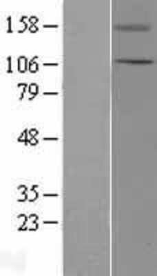 Western Blot: TRPC5 Overexpression Lysate [NBL1-17334]