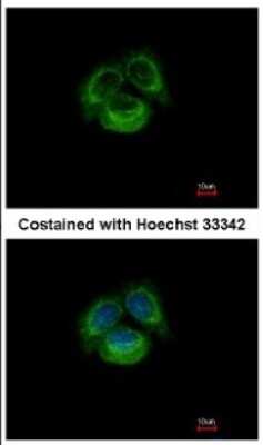 Immunocytochemistry/ Immunofluorescence: TRPC6 Antibody [NBP2-20737]