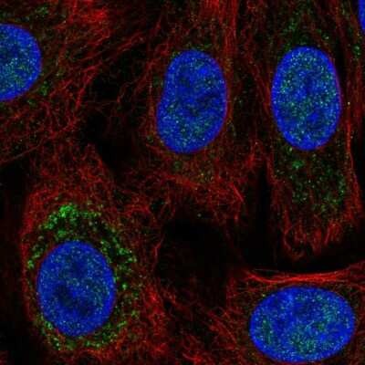 Immunocytochemistry/ Immunofluorescence: TRPC6 Antibody [NBP2-55831]