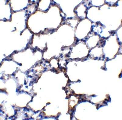 Immunohistochemistry-Paraffin: TRPC6 Antibody - BSA Free [NBP1-77260]