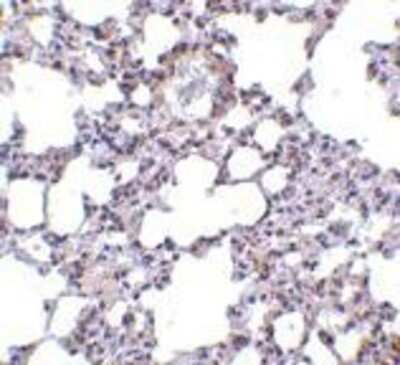 Immunohistochemistry-Paraffin: TRPC6 Antibody - BSA Free [NBP1-77261]