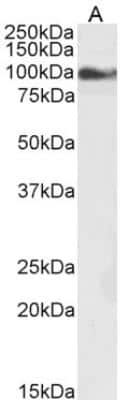 Western Blot: TRPC6 Antibody [NB600-791]