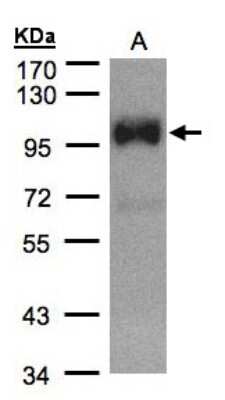 Western Blot: TRPC6 Antibody [NBP1-31008]