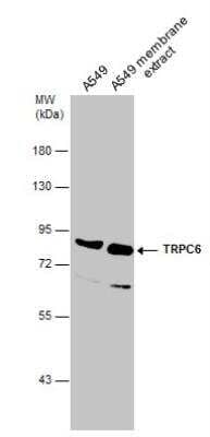 Western Blot: TRPC6 Antibody [NBP1-31008]