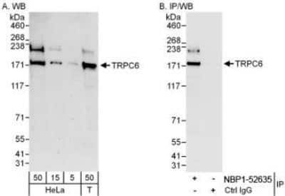 Western Blot: TRPC6 Antibody [NBP1-52635]