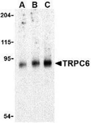 Western Blot: TRPC6 AntibodyBSA Free [NBP1-77260]