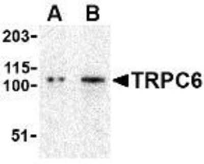 Western Blot: TRPC6 AntibodyBSA Free [NBP1-77261]