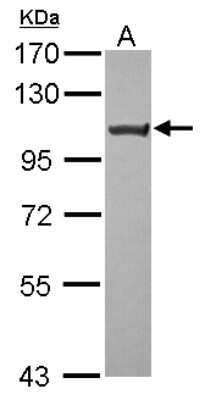 Western Blot: TRPC6 Antibody [NBP2-20737]