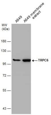 Western Blot: TRPC6 Antibody [NBP2-20737]