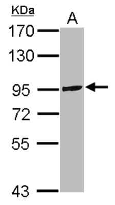 Western Blot: TRPC6 Antibody [NBP2-20738]