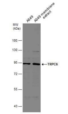 Western Blot: TRPC6 Antibody [NBP2-20738]