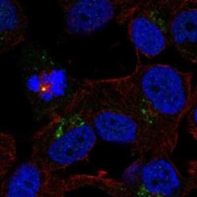 Immunocytochemistry/ Immunofluorescence: TRPM1 Antibody [NBP3-17450]