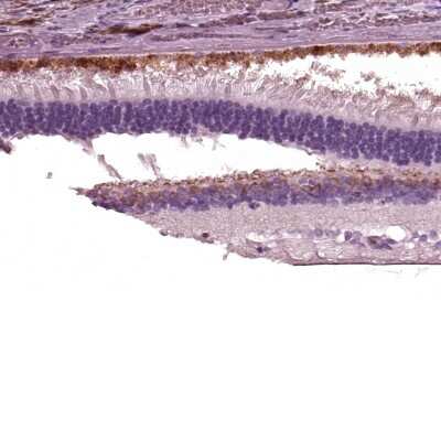 Immunohistochemistry-Paraffin: TRPM1 Antibody [NBP2-58415]