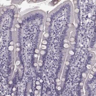 Immunohistochemistry-Paraffin: TRPM1 Antibody [NBP2-58415]