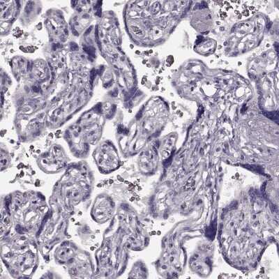 Immunohistochemistry-Paraffin: TRPM1 Antibody [NBP2-58415]