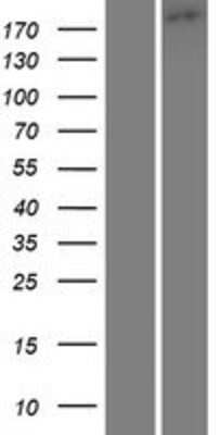 Western Blot: TRPM1 Overexpression Lysate [NBP2-08116]