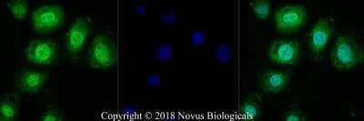 Immunocytochemistry/ Immunofluorescence: TRPM2 Antibody - BSA Free [NB110-81601]