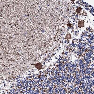Immunohistochemistry: TRPM2 Antibody [NBP2-48635]