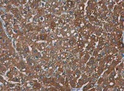 Immunohistochemistry-Paraffin: TRPM2 Antibody [NBP1-33416]