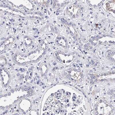 Immunohistochemistry-Paraffin: TRPM2 Antibody [NBP2-48635]