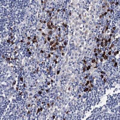 Immunohistochemistry-Paraffin: TRPM2 Antibody [NBP2-48635]