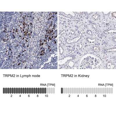 Immunohistochemistry-Paraffin: TRPM2 Antibody [NBP2-48635]