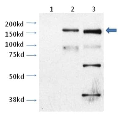 Western Blot: TRPM2 AntibodyBSA Free [NB110-81601]