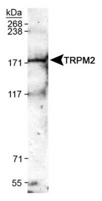 Western Blot: TRPM2 AntibodyBSA Free [NB110-82364]