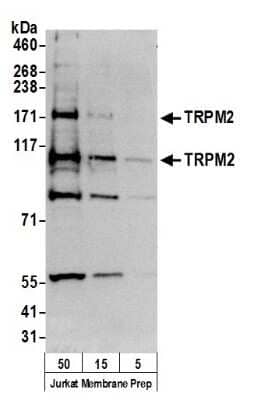 Western Blot: TRPM2 Antibody [NB500-242]