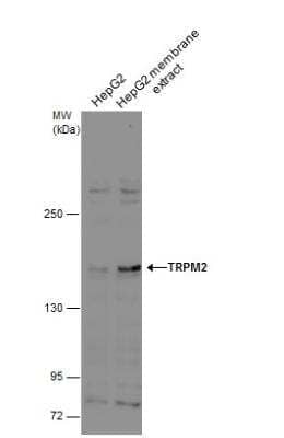 Western Blot: TRPM2 Antibody [NBP1-33416]