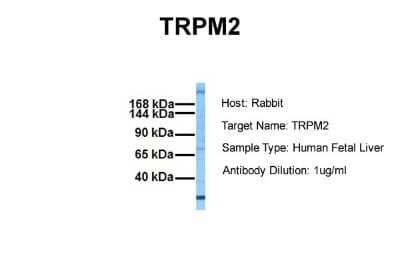 Western Blot: TRPM2 Antibody [NBP1-59618]