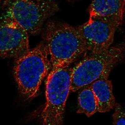 Immunocytochemistry/ Immunofluorescence: TRPM3 Antibody [NBP3-17069]