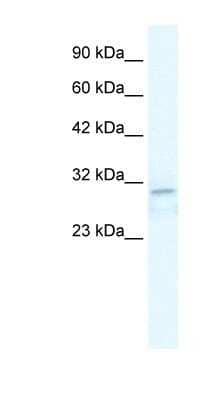 Western Blot: TRPM3 Antibody [NBP1-80210]