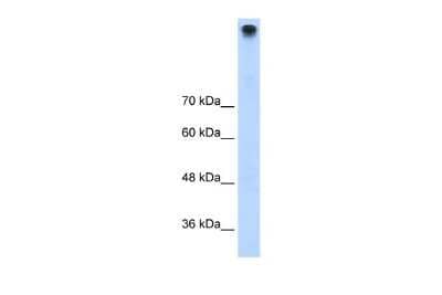 Western Blot: TRPM3 Antibody [NBP2-86876]