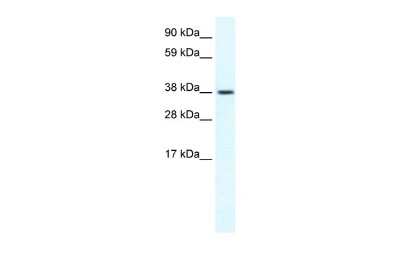 Western Blot: TRPM3 Antibody [NBP2-86877]