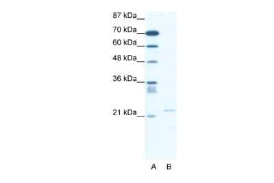 Western Blot: TRPM3 Antibody [NBP2-86878]